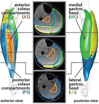 Achilles Tendon Morphology Is Related to Triceps Surae Muscle Size and Peak Plantarflexion Torques During Walking in Young but Not Older Adults